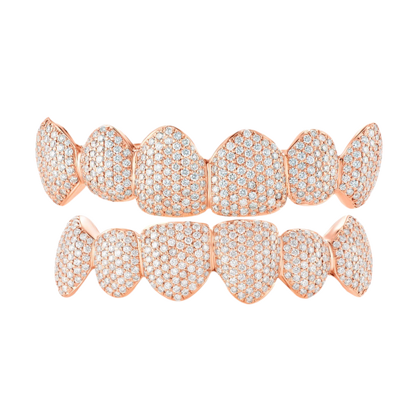 Gold Diamond Set Grillz